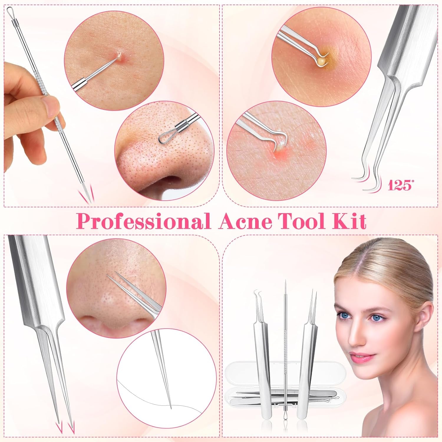 3Pcs Blackhead Tweezers, Stainless Steel Ingrown Hair Needle Kit with Box, Sebaceous Filament Tweezers, Milia Remover Milia Extraction Tools for Quick and Easy Removal of Pimples Blackheads Zit