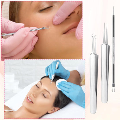 3Pcs Blackhead Tweezers, Stainless Steel Ingrown Hair Needle Kit with Box, Sebaceous Filament Tweezers, Milia Remover Milia Extraction Tools for Quick and Easy Removal of Pimples Blackheads Zit